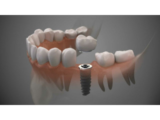 Allure Dental