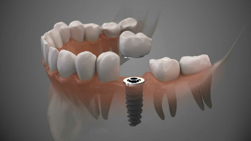 allure-dental-big-0